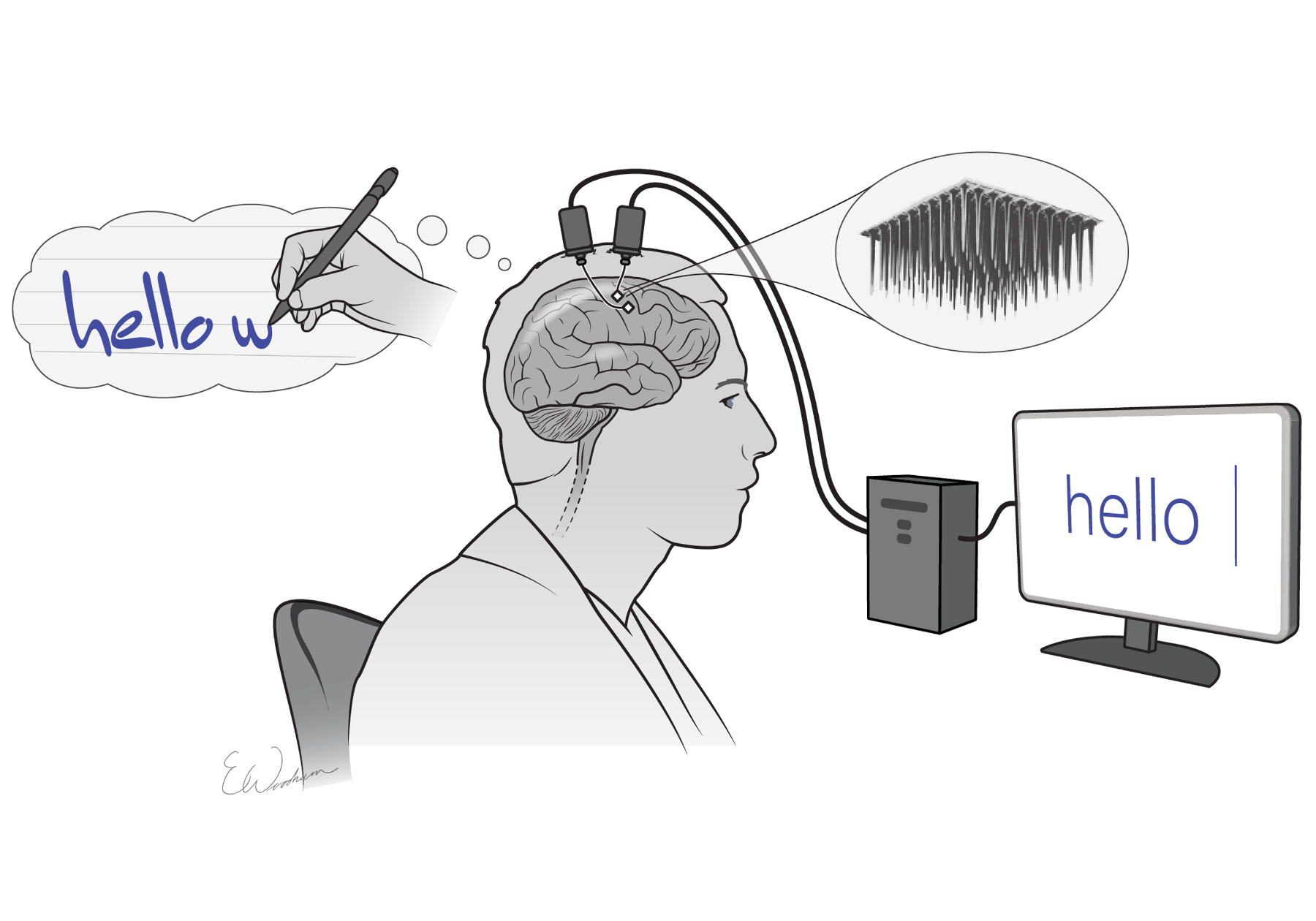 brain computer interface